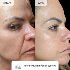 Line Refine Bundle Advanced