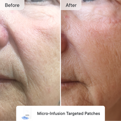 Line Refine Bundle Advanced