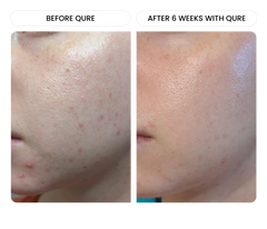 All-In-One Face Serum 8 ml