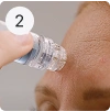 Microneedling treatment, step 2