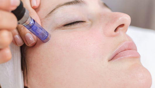 how long has microneedling been around