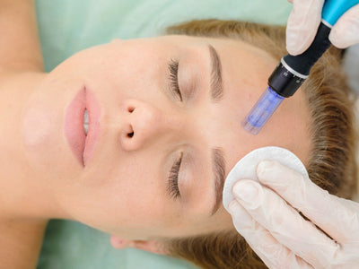 track marks after microneedling