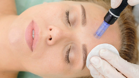 track marks after microneedling