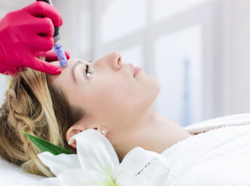 sun exposure after microneedling