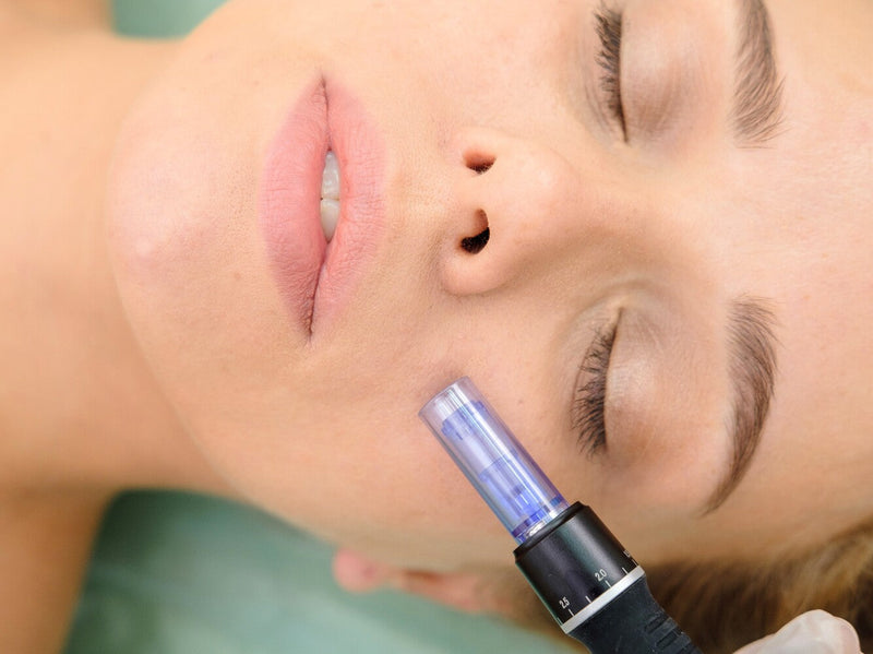 Botox vs microneedling