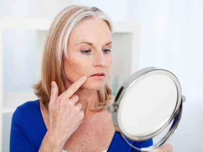 microneedling marionette lines