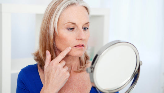 microneedling marionette lines