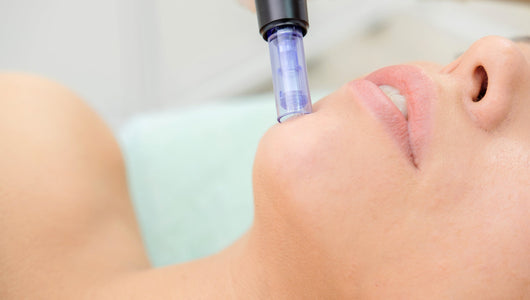 is microneedling worth it