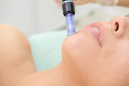 is microneedling worth it