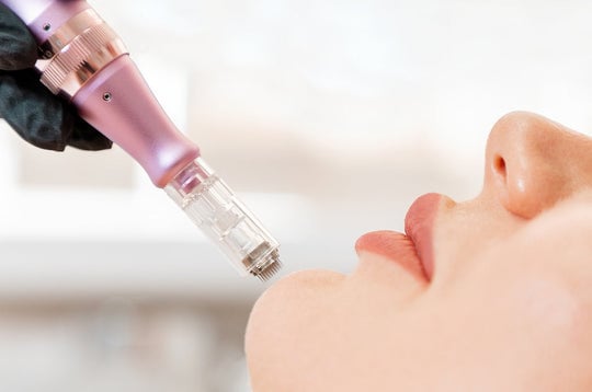 what is microneedling used for