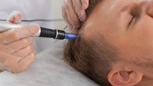 what to do after microneedling scalp