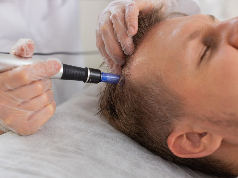 what to do after microneedling scalp