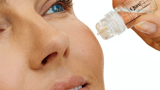 Who Is At-Home Microneedling Good for? The Answer May Surprise You