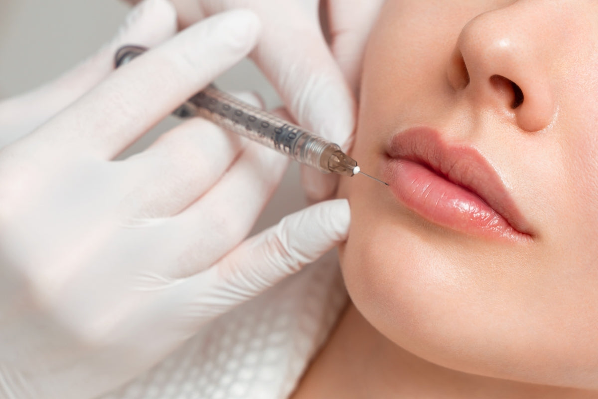 Lip filler injection procedure related to does red light therapy dissolve filler concerns.