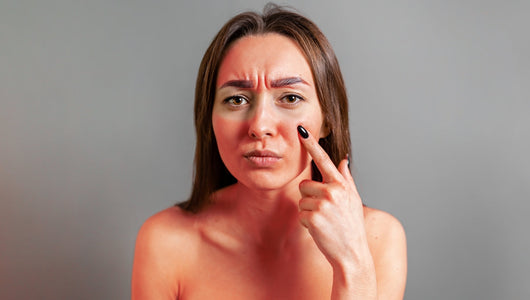 Model with sun-exposed skin highlighting timing of red light therapy before or after tanning.