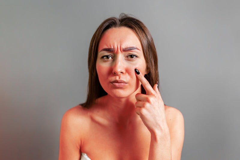 Model with sun-exposed skin highlighting timing of red light therapy before or after tanning.
