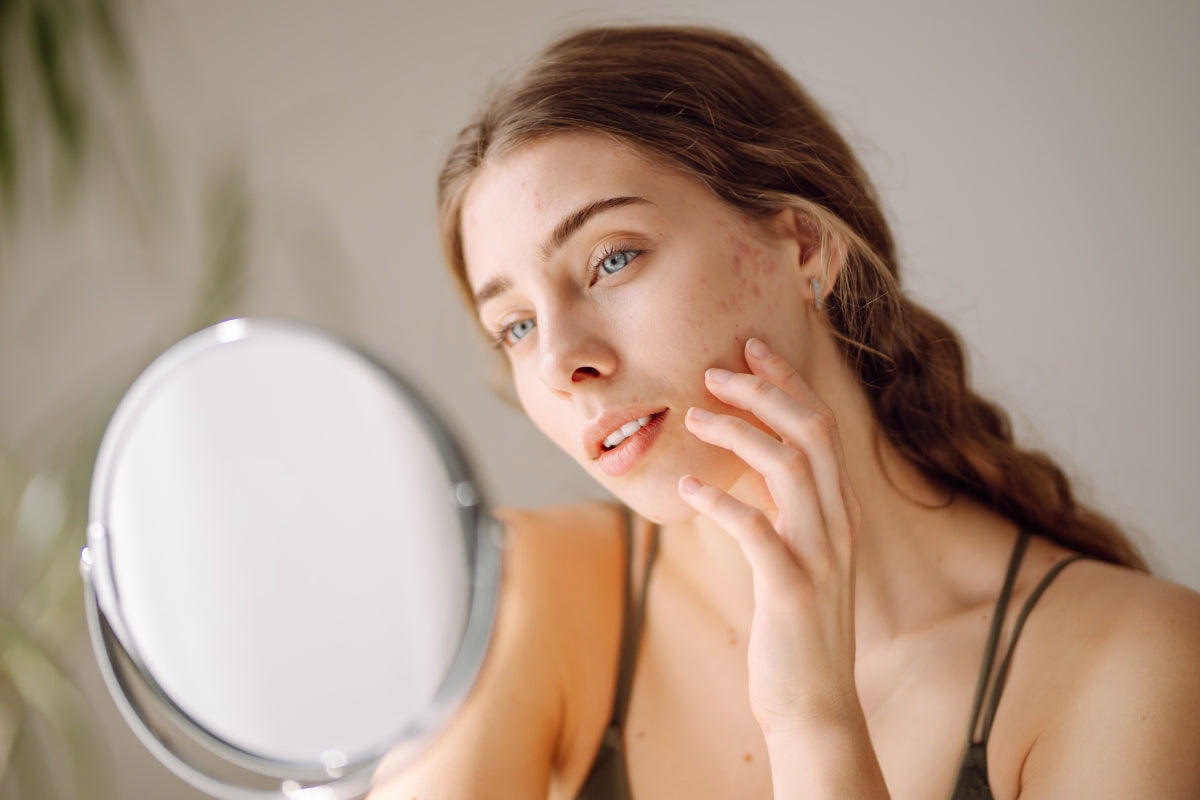 Woman looking in a small round mirror at facial acne, researching the best led face mask for acne treatment