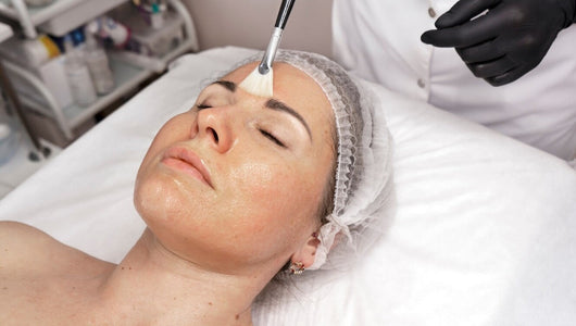 chemical peel vs microneedling