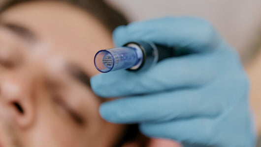 what to apply after microneedling