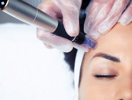 itching after microneedling