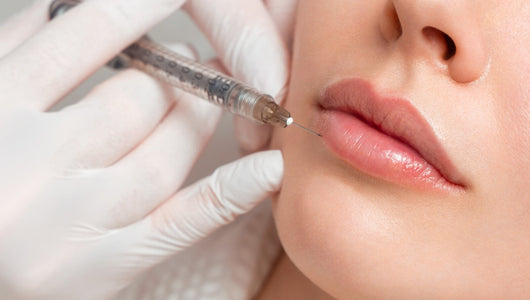 how long after microneedling can you get filler