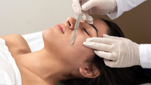 can you dermaplane before microneedling