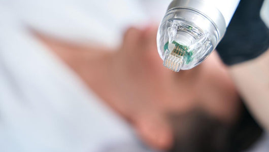 skinpen vs microneedling
