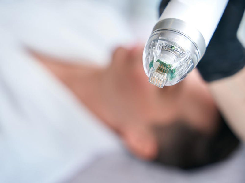 skinpen vs microneedling