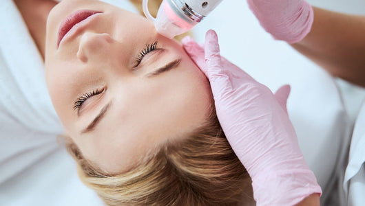 microneedling at home vs professional