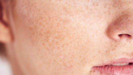 how long does red light therapy take to work