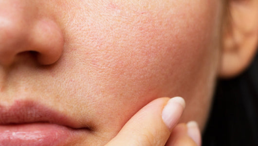 is blue light or red light better for acne
