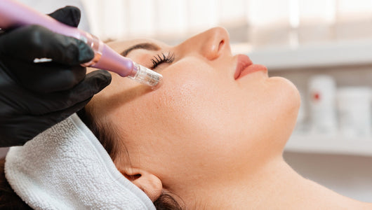 How Long Does Microneedling Take to Heal