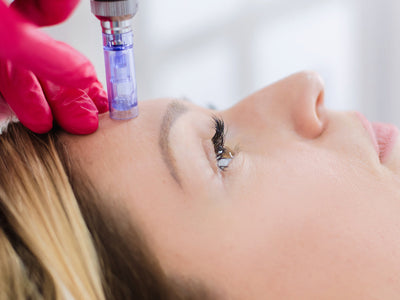 microneedling sensitive skin