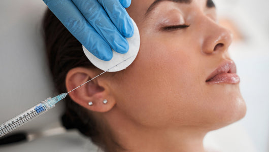 microneedling after filler
