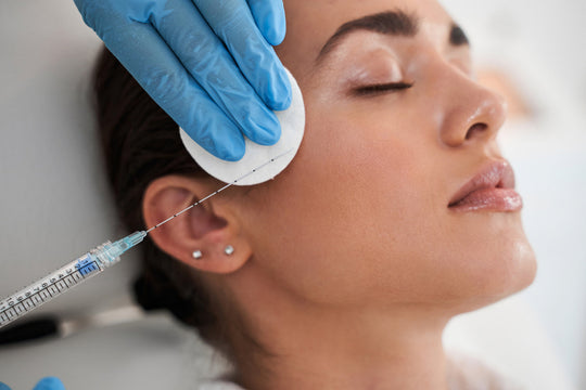 microneedling after filler