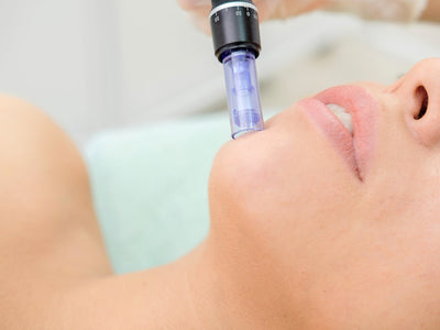 how long does microneedling last