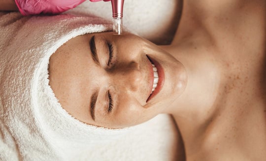 how long to see microneedling results