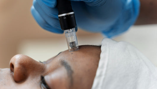 how often microneedling