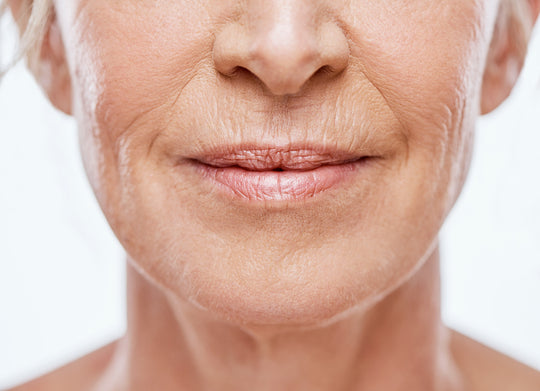 microneedling for wrinkles