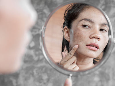 red light therapy melasma