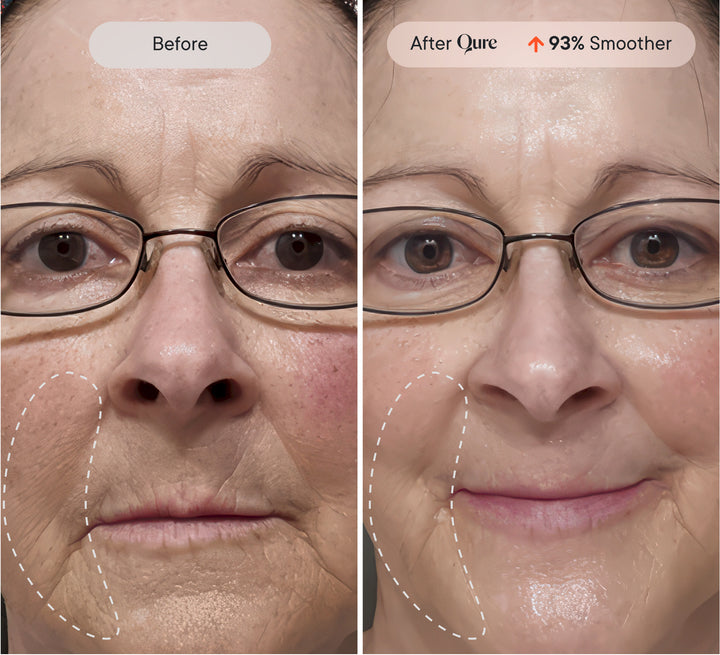 ghk-cu peptide injection before and after reddit ghk cu Experienxe : r/Peptides 5 Standout Beauty Launches From Qure Micro-Infusion System #1