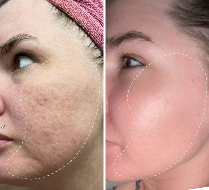 reddit ghk cu before and after Photos where to inject ghk cu