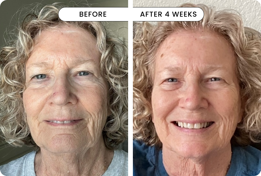 result All-In-One Face Serum