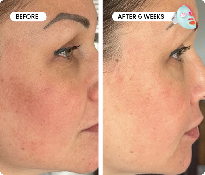 Fade & Firm Bundle Advanced