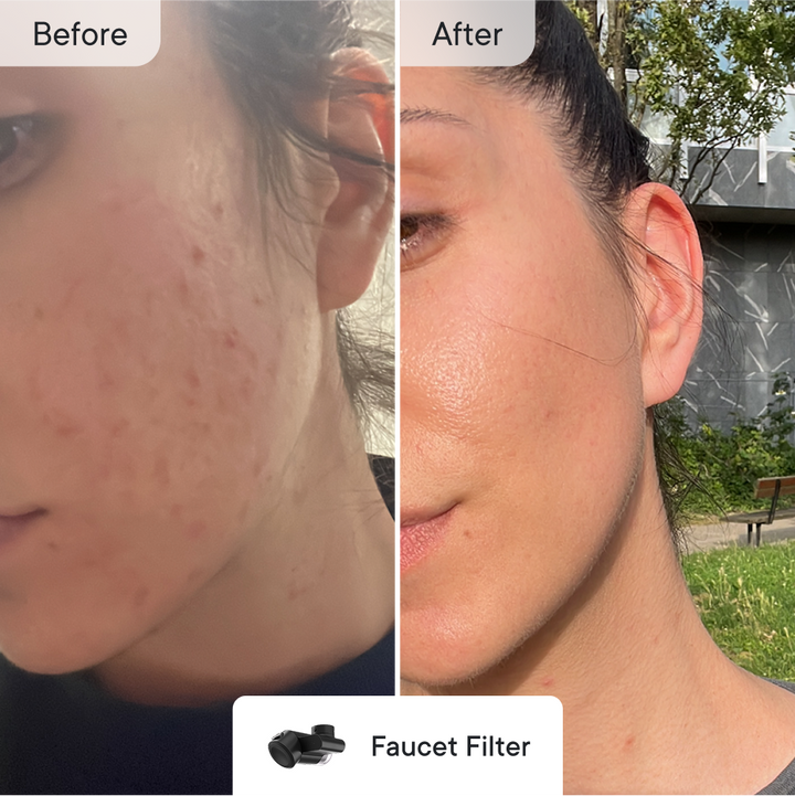 Breakout Control Essentials