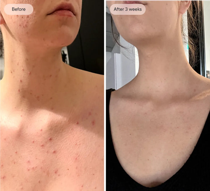 Image-1