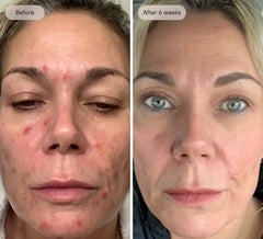 Image-1_converted