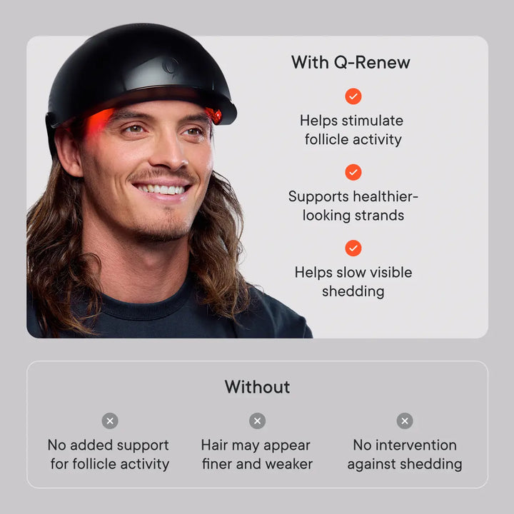 home shopping network lazer head helmet Q-Renew LLLT Helmet (Pre-Order)