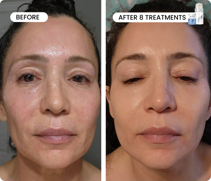 Line Refine Bundle Advanced