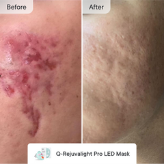 Breakout Control Pro